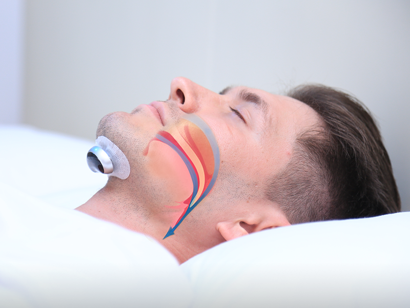Pulse technology anti-snoring device gadget for deep, quiet sleep & enhanced breathing support.