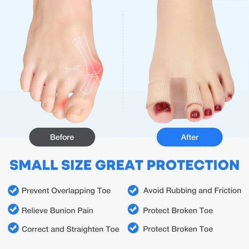 Soft gel lined toe separators offer bunion support, foot comfort & pain relief. Discreet, washable for everyday wear.
