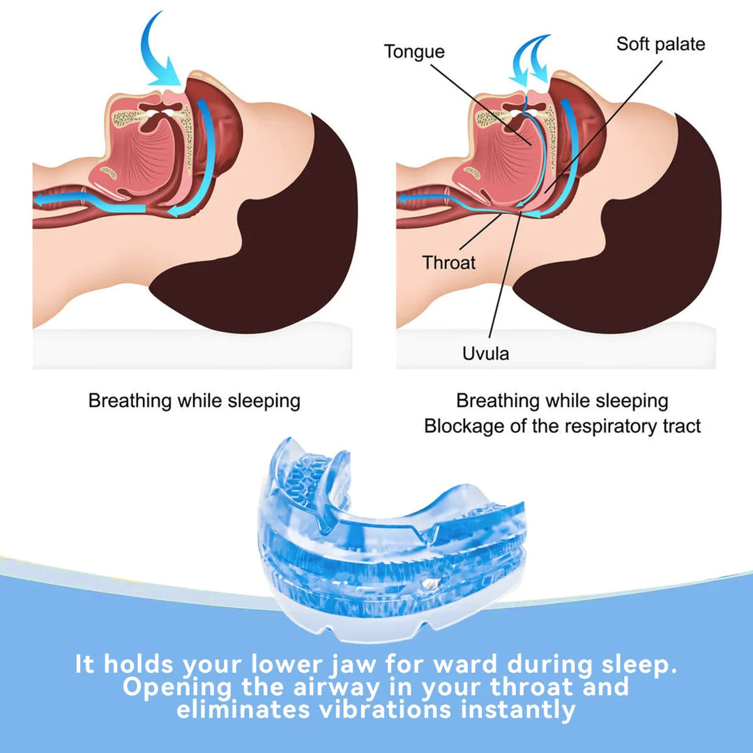 Close-up of a customizable unisex anti-snore dental guard. Helps provide snoring relief & promote restful sleep.