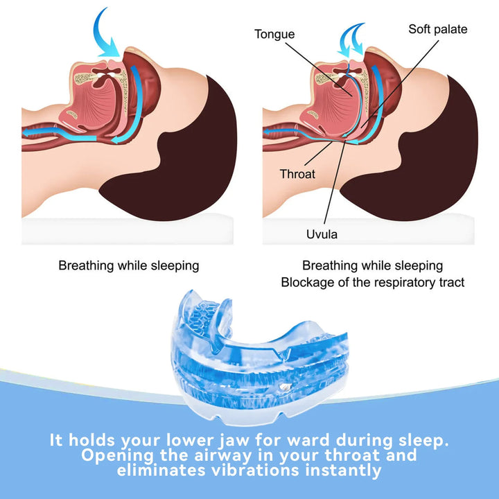 Close-up of a customizable unisex anti-snore dental guard. Helps provide snoring relief & promote restful sleep.