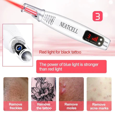 Achieve clear skin with this handheld laser spot & tattoo remover pen. Ideal for mole & freckle removal.