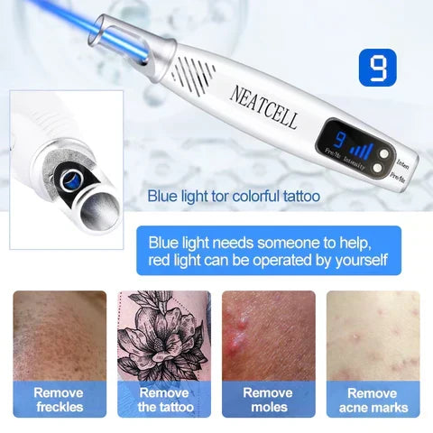Effective handheld laser pen for tattoo removal, mole removal, and skin rejuvenation. A versatile beauty tool.