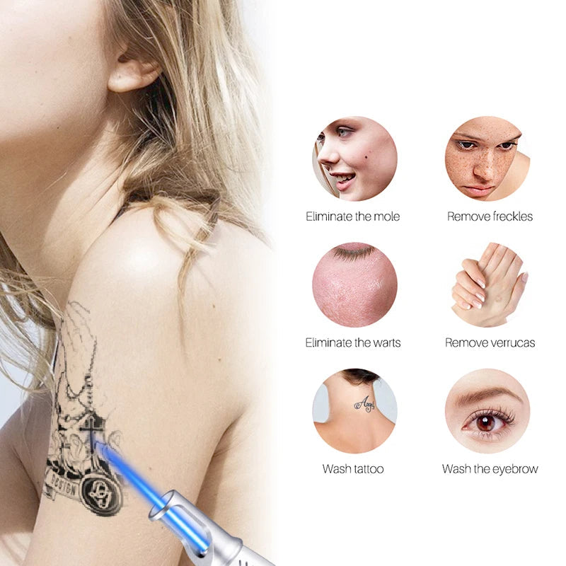Unisex laser pen for effective at-home tattoo, spot, & freckle removal. Improve skin clarity & confidence.