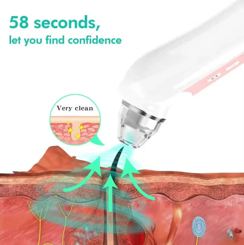 Rechargeable visual pore vacuum, an effective blackhead remover & facial cleanser with HD camera.