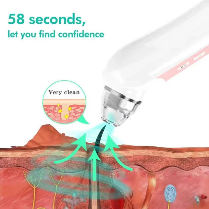 Rechargeable visual pore vacuum, an effective blackhead remover & facial cleanser with HD camera.