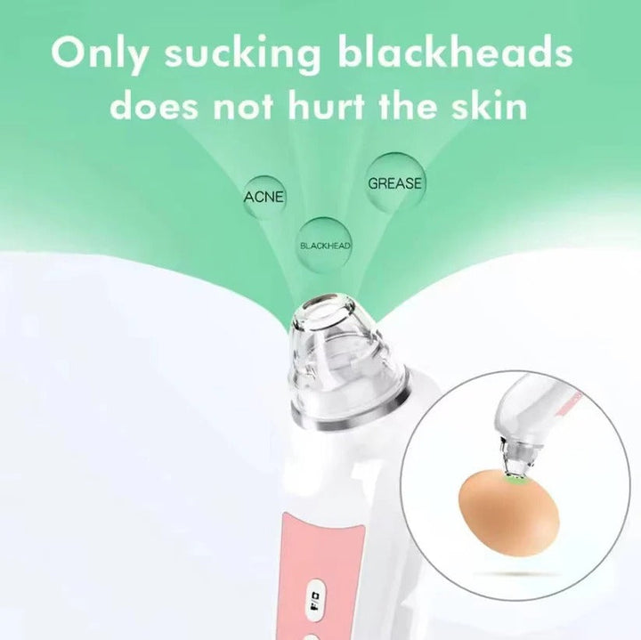 HD camera pore vacuum extractor, a smart beauty device & skincare tool for clear, healthy skin.