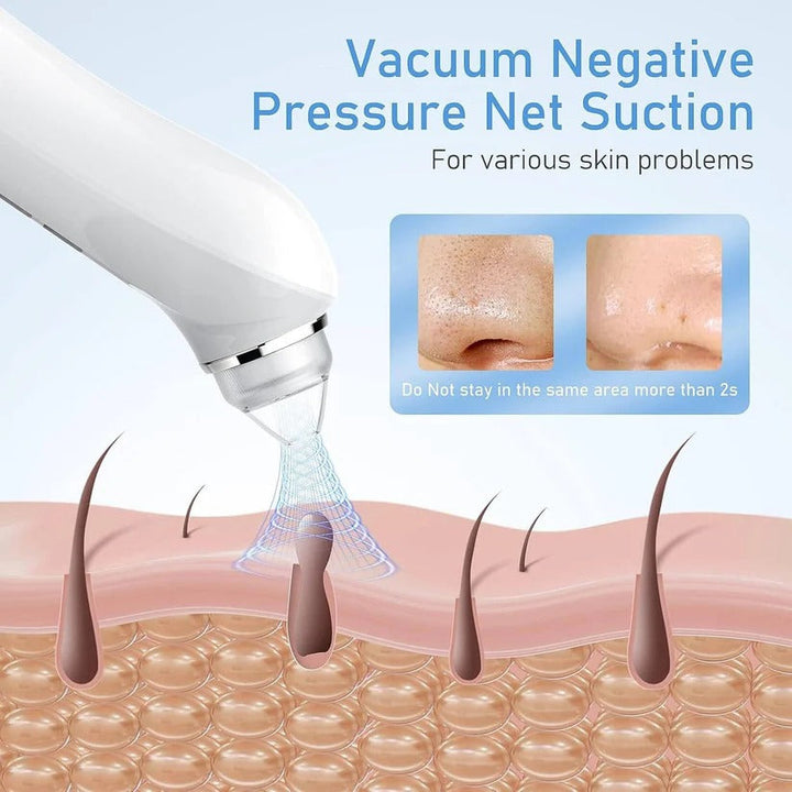 Achieve clear skin with this visual facial cleanser & blackhead remover featuring an HD camera.