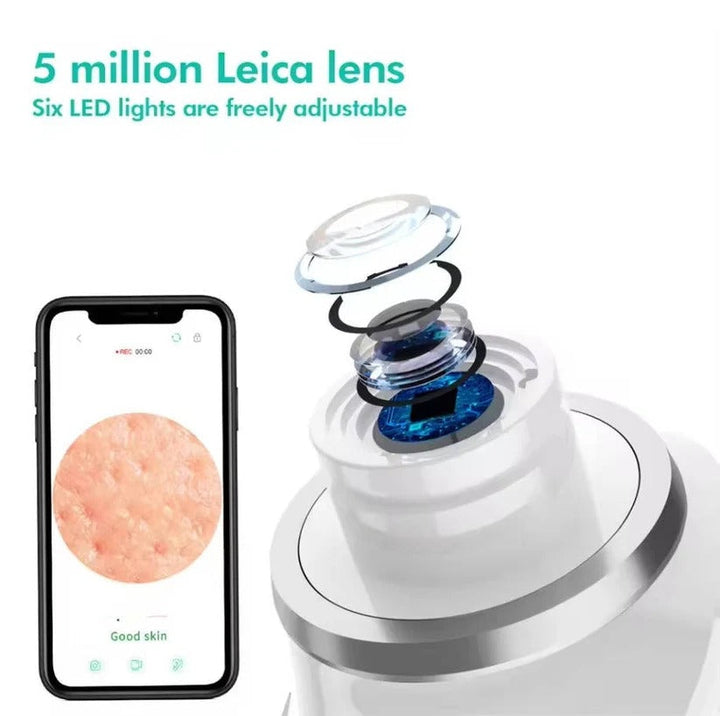 Powerful visual pore vacuum with HD camera for gentle yet effective blackhead and acne treatment.