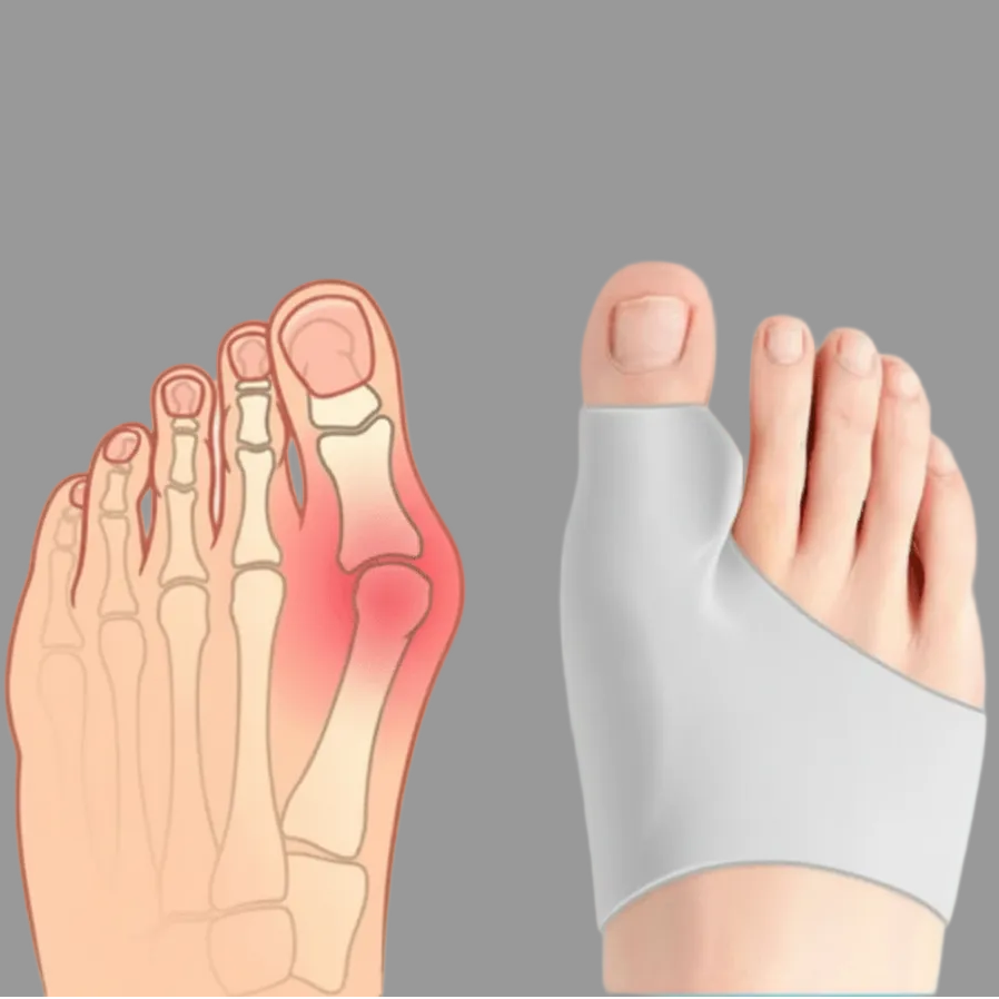 Easy-to-wear bunion corrector for youth, offering discreet foot alignment & gentle pain relief under socks & shoes.