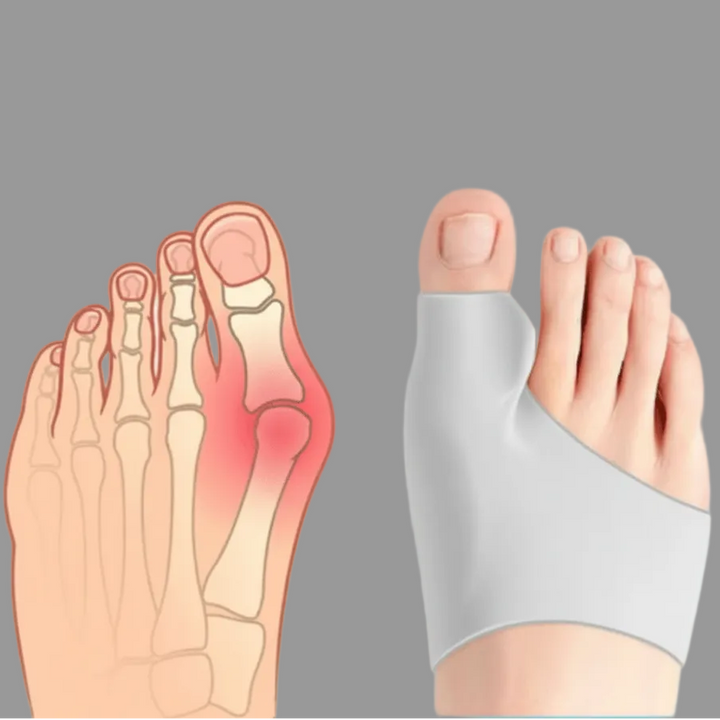 Easy-to-wear bunion corrector for youth, offering discreet foot alignment & gentle pain relief under socks & shoes.